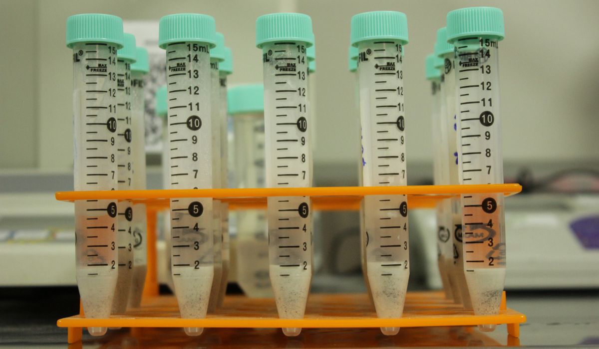 R Biohormigones muestras de bacterias